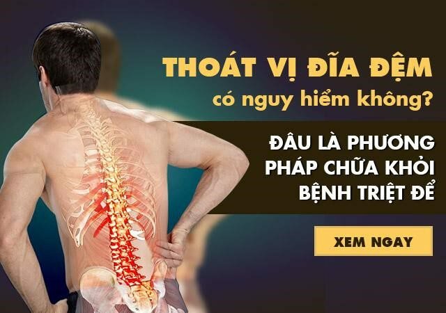 Thoát vị đĩa đệm có chữa khỏi được không ?